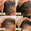 Hair Growth Oil - Natural Hair Growth & Scalp Care | Souqora